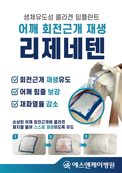 리제네텐