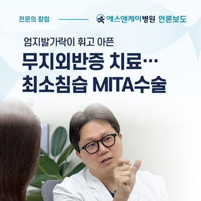 [중도일보] 엄지발가락이 휘고 아픈 무지외반증 치료…최소침습 MITA수술로